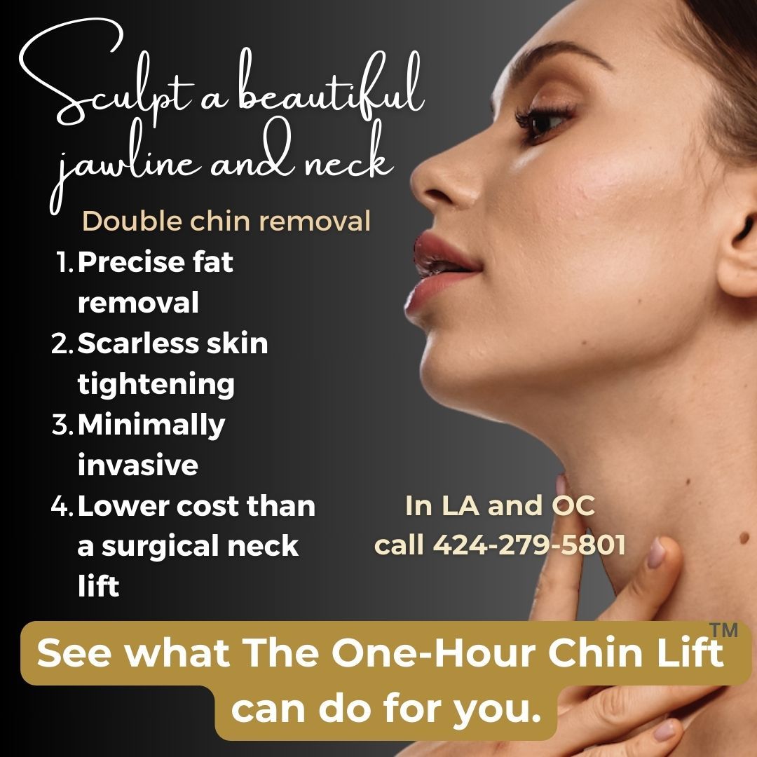 Double chin removal