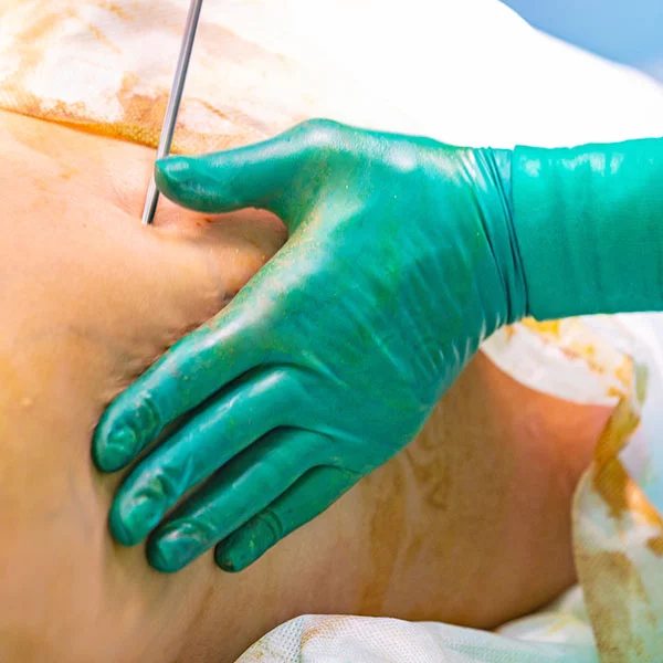 awakelipocenters.com